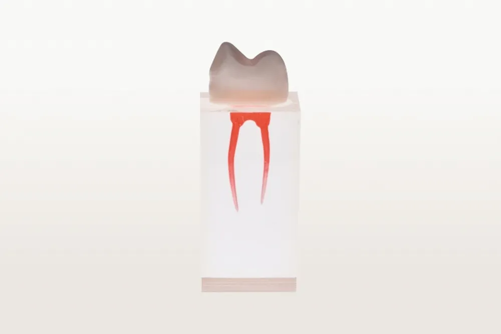 Endodoncia birradicular