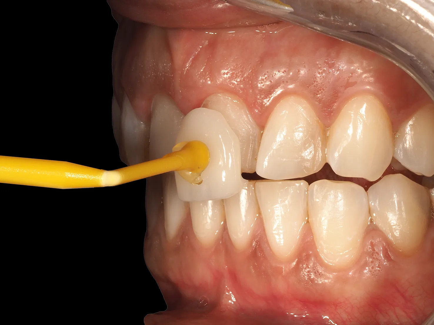 Estética dental