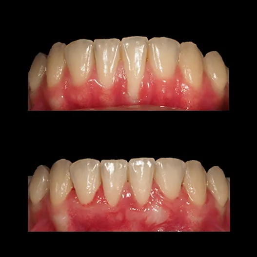 Periodoncia