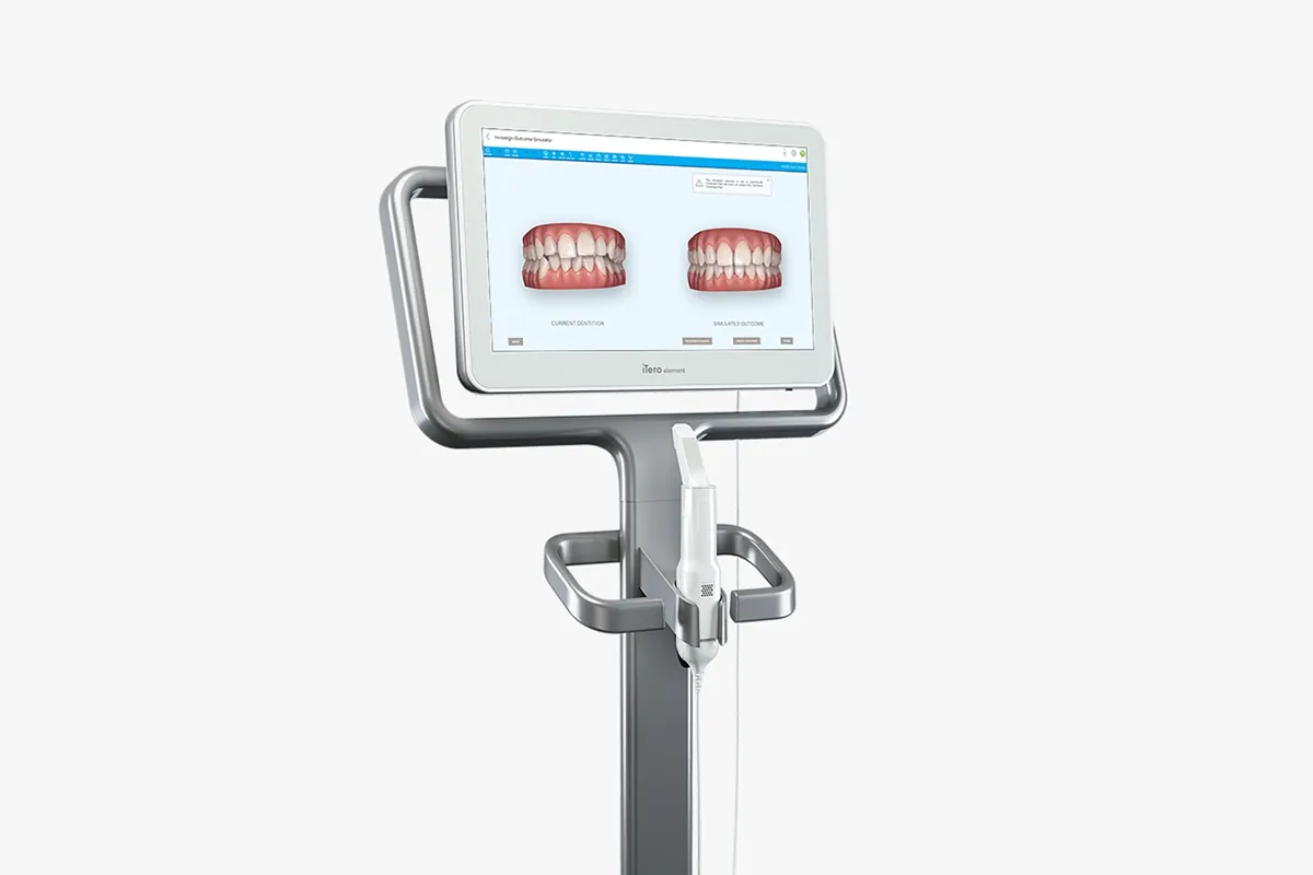 Escaner Intraoral 3D - Impresiones digitales